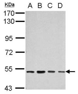 Western Blot: SOX30 Antibody [NBP2-20457]