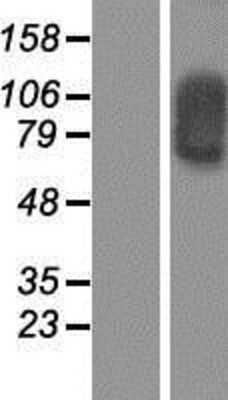 Western Blot: SOX30 Overexpression Lysate [NBP2-04971]