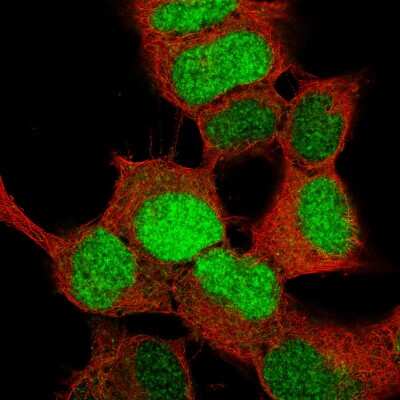 Immunocytochemistry/ Immunofluorescence: SOX4 Antibody (CL5634) [NBP2-61420]