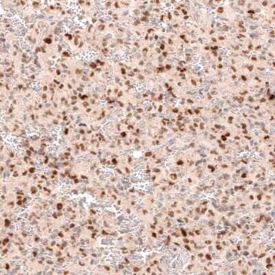 Immunohistochemistry-Paraffin: SOX4 Antibody (CL5634) [NBP2-61420]
