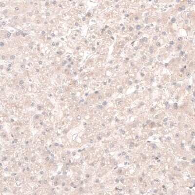 Immunohistochemistry-Paraffin: SOX4 Antibody (CL5634) [NBP2-61420]