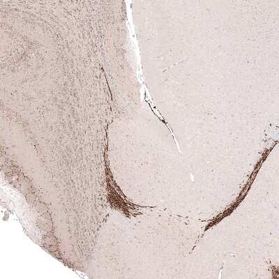 Immunohistochemistry-Paraffin: SOX4 Antibody (CL5634) [NBP2-61420]