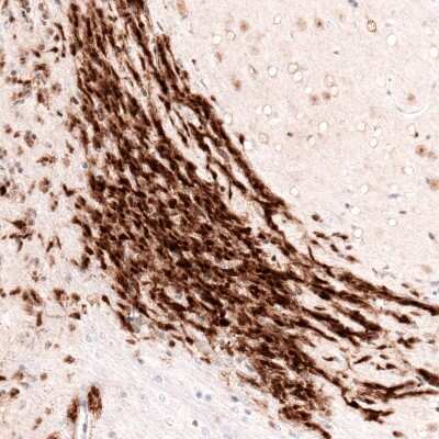 Immunohistochemistry-Paraffin: SOX4 Antibody (CL5634) [NBP2-61420]