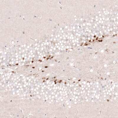 Immunohistochemistry-Paraffin: SOX4 Antibody (CL5634) [NBP2-61420]