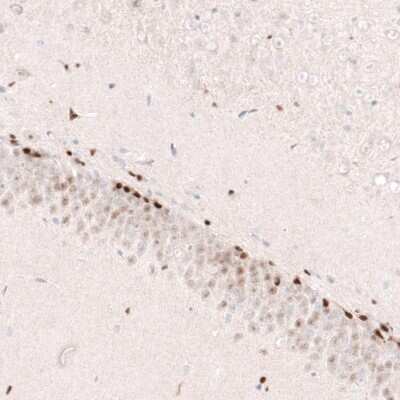 Immunohistochemistry-Paraffin: SOX4 Antibody (CL5634) [NBP2-61420]