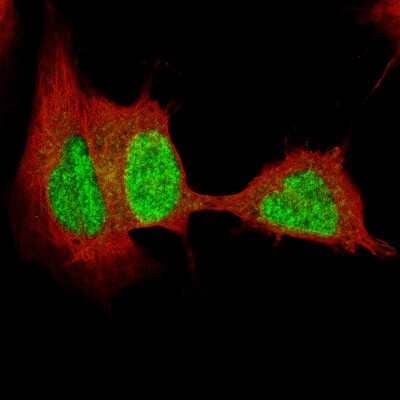 Immunocytochemistry/ Immunofluorescence: SOX4 Antibody (CL5665) [NBP2-61421]