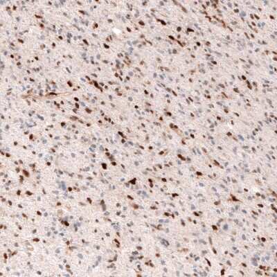 Immunohistochemistry-Paraffin: SOX4 Antibody (CL5665) [NBP2-61421]