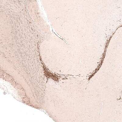 Immunohistochemistry-Paraffin: SOX4 Antibody (CL5665) [NBP2-61421]