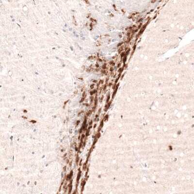 Immunohistochemistry-Paraffin: SOX4 Antibody (CL5665) [NBP2-61421]