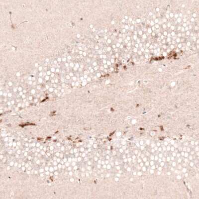 Immunohistochemistry-Paraffin: SOX4 Antibody (CL5665) [NBP2-61421]