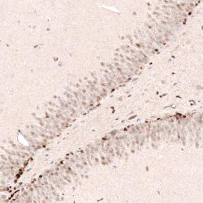 Immunohistochemistry-Paraffin: SOX4 Antibody (CL5665) [NBP2-61421]