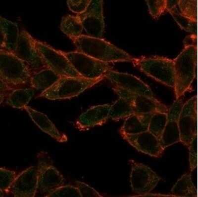 Immunocytochemistry/ Immunofluorescence: SOX4 Antibody (PCRP-SOX4-1D6) [NBP3-13777]