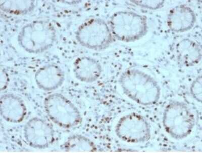 Immunohistochemistry-Paraffin: SOX4 Antibody (PCRP-SOX4-1D6) [NBP3-13777]