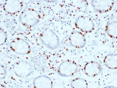 Immunohistochemistry-Paraffin: SOX4 Antibody (SOX4/2540) - Azide and BSA Free [NBP2-79903]