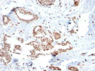 Immunohistochemistry-Paraffin: SOX4 Antibody (SOX4/2540) - Azide and BSA Free [NBP2-79903]