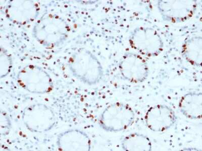 Immunohistochemistry-Paraffin: SOX4 Antibody (SOX4/2540) [NBP2-79768]