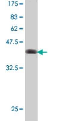 Western Blot: SOX4 Antibody [H00006659-A01]