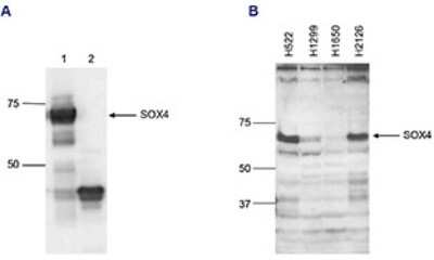 Western Blot: SOX4 Antibody [NBP3-18643]