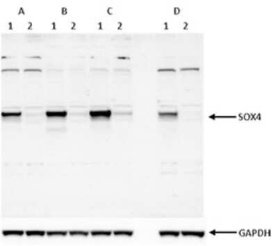 Western Blot: SOX4 Antibody [NBP3-18643]
