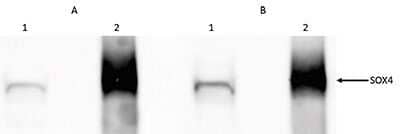 Western Blot: SOX4 Antibody [NBP3-18643]