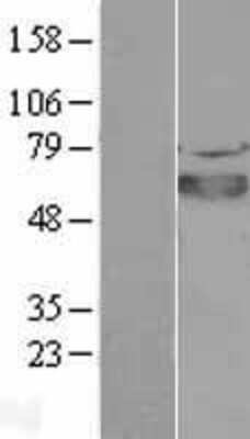 Western Blot: SOX4 Overexpression Lysate [NBL1-16352]