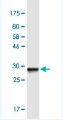 Western Blot: SOX5 Antibody (4H8) [H00006660-M01-100ug]