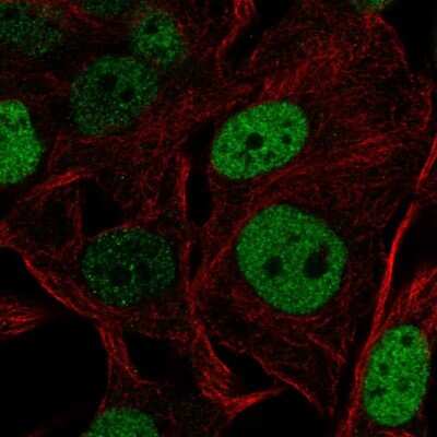 Immunocytochemistry/ Immunofluorescence: SOX5 Antibody [NBP2-56571]