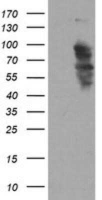 Western Blot: SOX5 Antibody (OTI2A8)Azide and BSA Free [NBP2-74301]