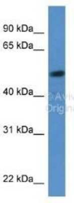 Western Blot: SOX5 Antibody [NBP1-74096]