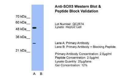 Western Blot: SOX5 Antibody [NBP1-74096]