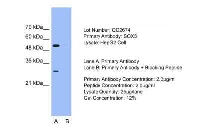 Western Blot: SOX5 Antibody [NBP1-74096]