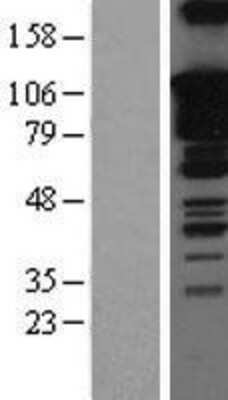 Western Blot: SOX5 Overexpression Lysate [NBL1-16353]