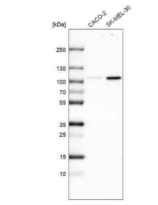 Western Blot: SOX6 Antibody (CL5685) [NBP2-61422]