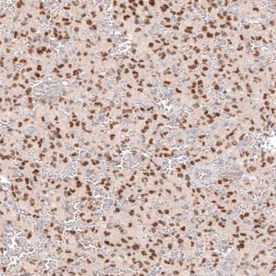 Immunohistochemistry-Paraffin: SOX6 Antibody (CL5690) [NBP2-61423]