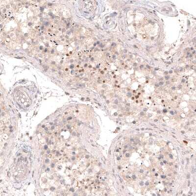 Immunohistochemistry-Paraffin: SOX6 Antibody (CL5690) [NBP2-61423]