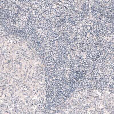 Immunohistochemistry-Paraffin: SOX6 Antibody (CL5690) [NBP2-61423]