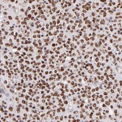 Immunohistochemistry-Paraffin: SOX6 Antibody [NBP1-85811]