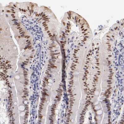 Immunohistochemistry-Paraffin: SOX6 Antibody [NBP1-85811]
