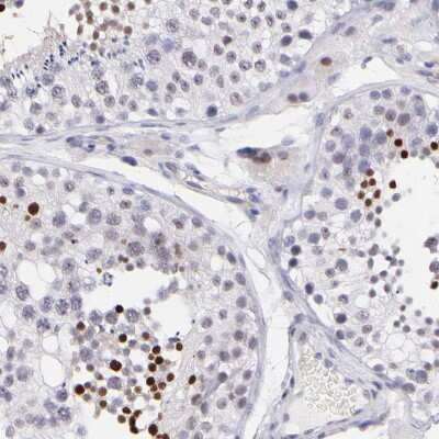 Immunohistochemistry-Paraffin: SOX6 Antibody [NBP1-85811]