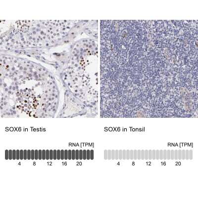 Immunohistochemistry-Paraffin: SOX6 Antibody [NBP1-85811]