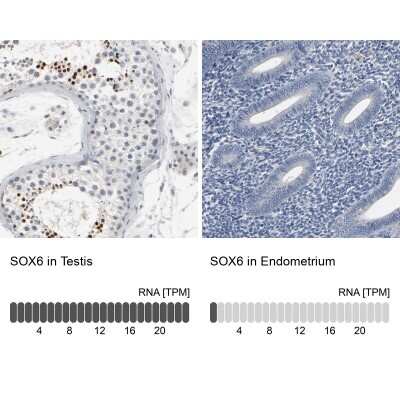 Immunohistochemistry-Paraffin: SOX6 Antibody [NBP1-86149]