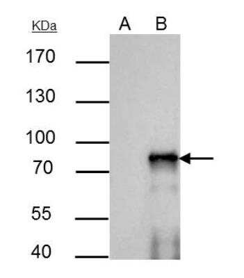 Immunoprecipitation: SOX6 Antibody [NBP2-20458]