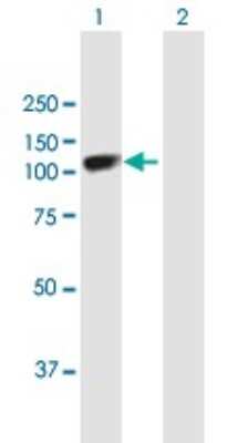 Western Blot: SOX6 Antibody [H00055553-B01P]