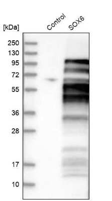 Western Blot: SOX6 Antibody [NBP1-86149]