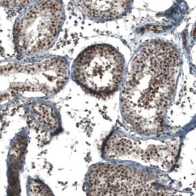 Immunohistochemistry-Paraffin: SOX7 Antibody [NBP1-86116]