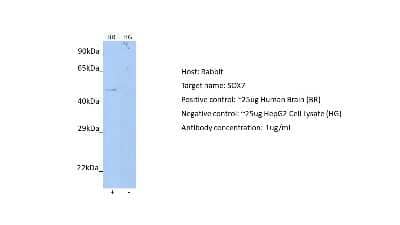 Western Blot: SOX7 Antibody [NBP1-80374]