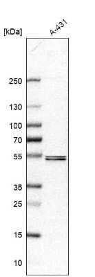 Western Blot: SOX7 Antibody [NBP1-86116]