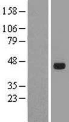 Western Blot: SOX7 Overexpression Lysate [NBL1-16355]