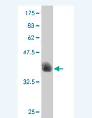 Western Blot: SOX8 Antibody (8D8) [H00030812-M02]