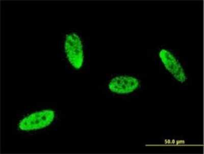 Immunocytochemistry/ Immunofluorescence: SOX8 Antibody (8G7) [H00030812-M01]